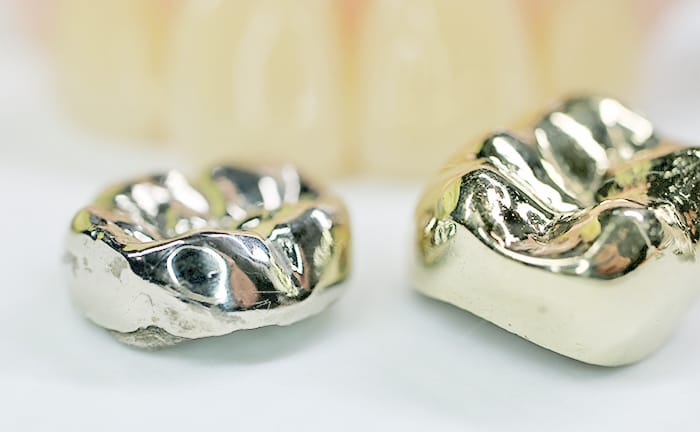 金属アレルギーで悩んでいる