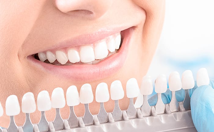 長持ちする白さを手に入れたい方