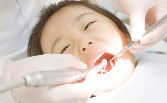 お子様の治療の写真